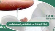 شكل الإفرازات بعد فشل تلقيح البويضة بالصور