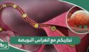 تجاربكم مع انغراس البويضة