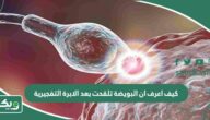 كيف اعرف ان البويضة تلقحت بعد الابرة التفجيرية