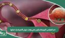 دم انغراس البويضة يكون في وقت نزول الدورة ولا قبلها