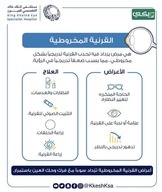 مستشفى الملك خالد التخصصي للعيون